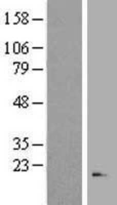 Western Blot: RNASE3 Overexpression Lysate [NBP2-08055]