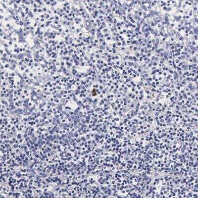 Immunohistochemistry-Paraffin: RNASE6 Antibody [NBP1-80822]