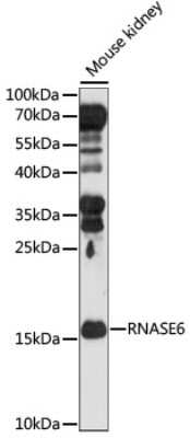 Western Blot: RNASE6 AntibodyAzide and BSA Free [NBP2-94645]