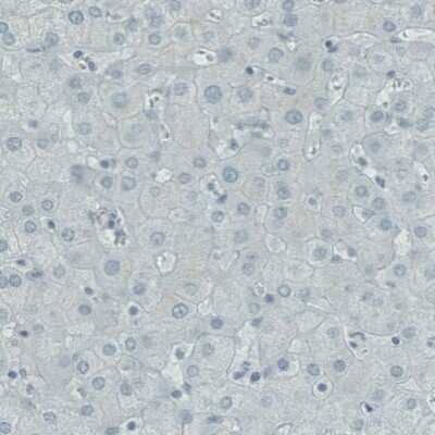 Immunohistochemistry-Paraffin: RNASE7 Antibody (CL0223) [NBP2-52883]