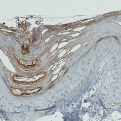 Immunohistochemistry-Paraffin: RNASE7 Antibody (CL0223) [NBP2-52883]