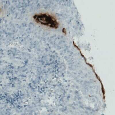 Immunohistochemistry-Paraffin: RNASE7 Antibody (CL0223) [NBP2-52883]