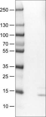 Western Blot: RNASE7 Antibody (CL0223) [NBP2-52883]