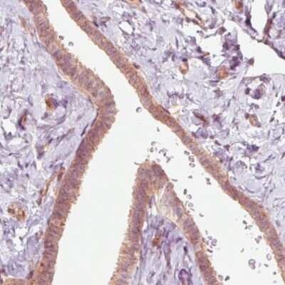 Immunohistochemistry-Paraffin: RNASE7 Antibody (CL0224) [NBP2-52884]