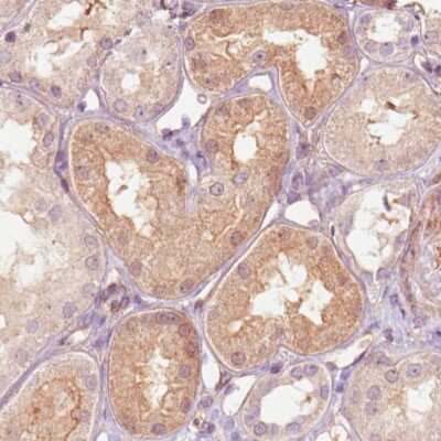 Immunohistochemistry-Paraffin: RNASE7 Antibody (CL0224) [NBP2-52884]