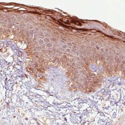 Immunohistochemistry-Paraffin: RNASE7 Antibody (CL0224) [NBP2-52884]