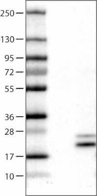 Western Blot: RNASE7 Antibody (CL0224) [NBP2-52884]