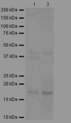 Western Blot: RNASE7 Antibody [NBP2-46606]