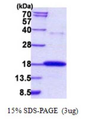 SDS-PAGE: Recombinant Human RNASE7 His Protein [NBP2-22634]