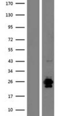 Western Blot: RNASE9 Overexpression Lysate [NBP2-09372]