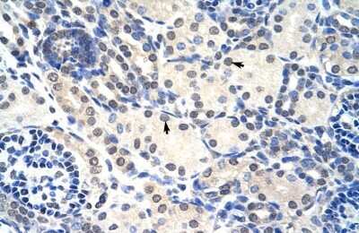 Immunohistochemistry-Paraffin: RNASEH2A Antibody [NBP1-58234]