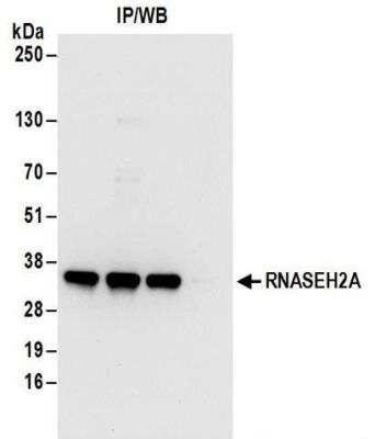 Immunoprecipitation: RNASEH2A Antibody [NBP2-32144]