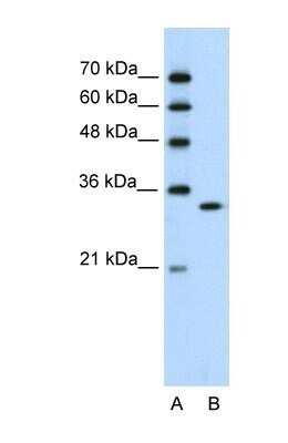 Western Blot: RNASEH2A Antibody [NBP1-58234]