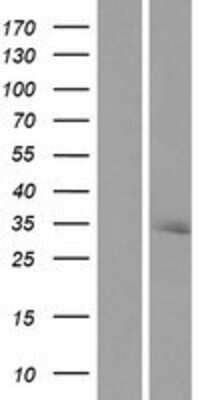 Western Blot: RNASEH2A Overexpression Lysate [NBP2-07624]