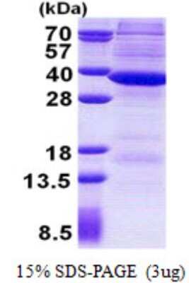 SDS-PAGE: Recombinant Human RNASEH2A His Protein [NBP2-23414]