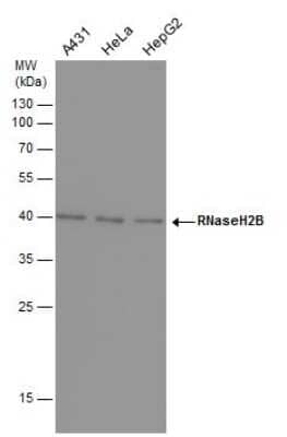 Western Blot: RNASEH2B Antibody (419) [NBP2-43774]