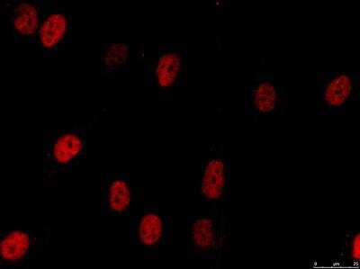 Immunocytochemistry/ Immunofluorescence: RNASEH2B Antibody (673) [NBP2-43776]