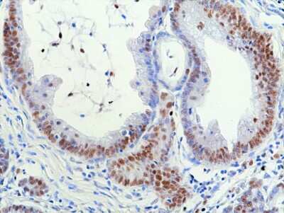 Immunohistochemistry-Paraffin: RNASEH2B Antibody (RM433) [NBP3-09181]