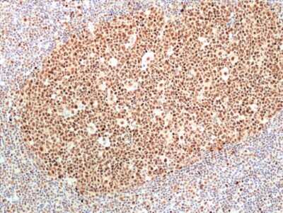 Immunohistochemistry-Paraffin: RNASEH2B Antibody (RM433) [NBP3-09181]