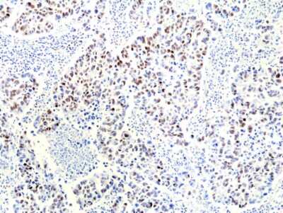 Immunohistochemistry-Paraffin: RNASEH2B Antibody (RM433) [NBP3-09181]