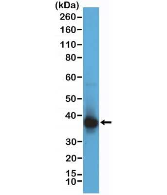 Western Blot: RNASEH2B Antibody (RM433) [NBP3-09181]