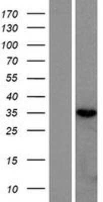 Western Blot: RNASEH2B Overexpression Lysate [NBP2-06319]