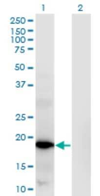 Western Blot: RNASEH2C Antibody (5D6) [H00084153-M02]