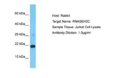 Western Blot: RNASEH2C Antibody [NBP2-85643]