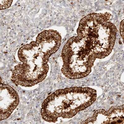 Immunohistochemistry-Paraffin: RNASET2 Antibody [NBP1-88753]