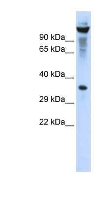 Western Blot: RNASET2 Antibody [NBP1-80017]