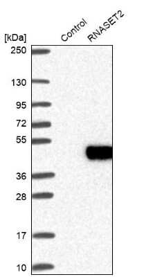 Western Blot: RNASET2 Antibody [NBP1-88753]