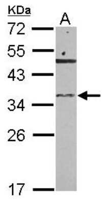 Western Blot: RNASET2 Antibody [NBP2-20173]