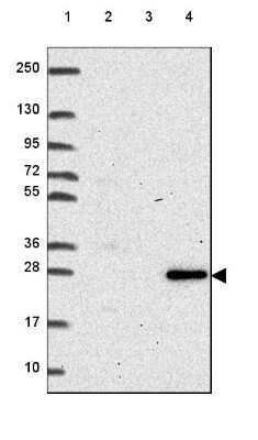 Western Blot: RNASET2 Antibody [NBP2-49484]