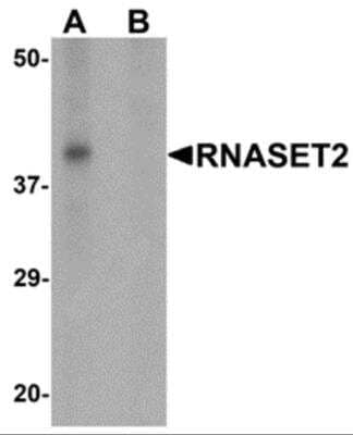 Western Blot: RNASET2 AntibodyBSA Free [NBP2-81890]