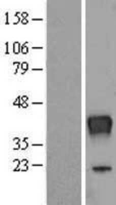 Western Blot: RNASET2 Overexpression Lysate [NBP2-07960]