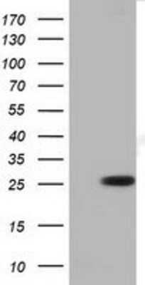 Western Blot: RND1 Antibody (OTI1C3) [NBP2-03000]