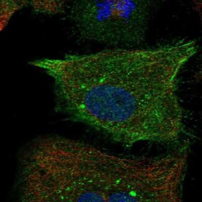 Immunocytochemistry/ Immunofluorescence: RND1 Antibody [NBP2-57985]