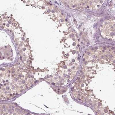 Immunohistochemistry: RND2 Antibody [NBP2-69052]