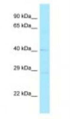 Western Blot: RND2 Antibody [NBP1-98542]