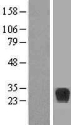 Western Blot: RND2 Overexpression Lysate [NBP2-07750]