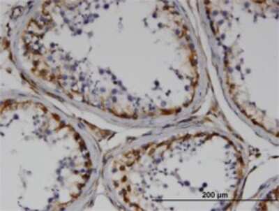 Immunohistochemistry-Paraffin: RND3 Antibody (1D2) [H00000390-M01]