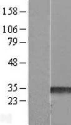 Western Blot: RND3 Overexpression Lysate [NBL1-15405]