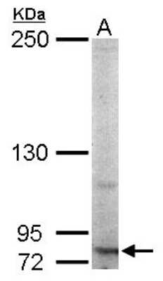 Western Blot: RNF10 Antibody [NBP2-20174]