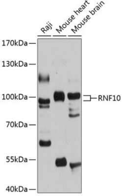 Western Blot: RNF10 AntibodyAzide and BSA Free [NBP2-93965]