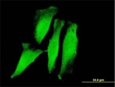 Immunocytochemistry/ Immunofluorescence: RNF11 Antibody (4G7) [H00026994-M01]