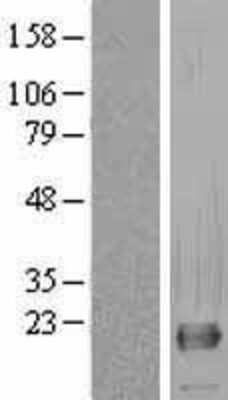 Western Blot: RNF11 Overexpression Lysate [NBL1-15408]