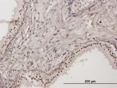 Immunohistochemistry-Paraffin: RNF111 Antibody [H00054778-B01P]