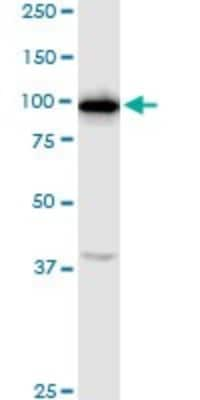 Western Blot: RNF111 Antibody [H00054778-D01P]