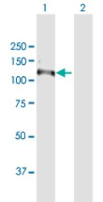 Western Blot: RNF111 Antibody [H00054778-D01P]