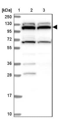 Western Blot: RNF111 Antibody [NBP1-94140]